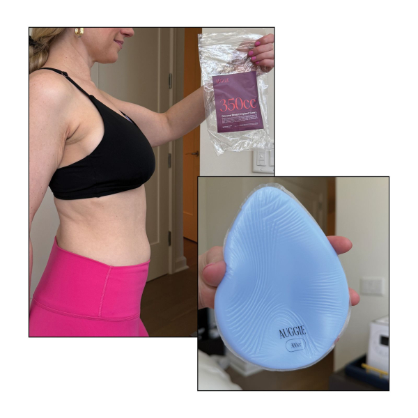 How I Shopped for the Perfect Breast Implants